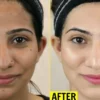 Instant Whitening Cream + Serum + Free gift