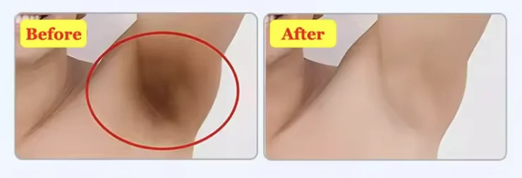instant whitening cream x2