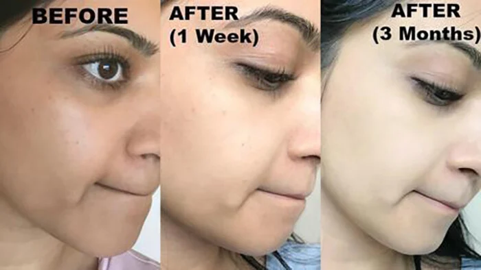 Instant Whitening Cream + Serum + Free gift